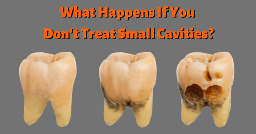 what-happens-if-you-don-t-treat-small-cavities-dental-insurance-insiders